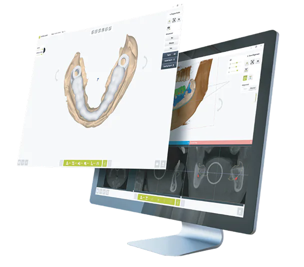 Dentium Surgical Guide
